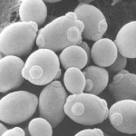 saccharomyces