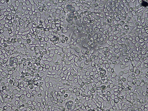 Saccharomyces cerevisiae (400X).jpg