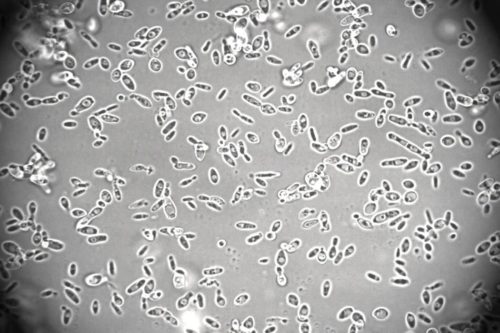 brettanomyces